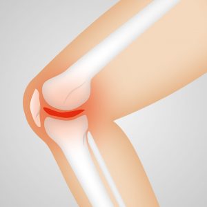 Ochrona kolan – stabilizatory kolanowe – chroni staw kolanowy