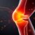 Hyalofast w rehabilitacji – innowacyjne wsparcie dla stawów